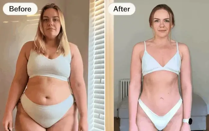 lipotrine-before-after-patricia